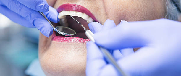Emergency Dental Filling Replacement in OR