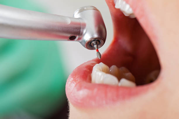 Best Dentist for Tooth Abscess  in Roseburg Nth, OR